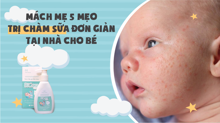 Mách mẹ 5 mẹo trị chàm sữa đơn giản tại nhà cho bé