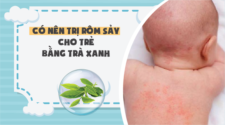 Có nên dùng trà xanh để trị rôm sảy cho trẻ