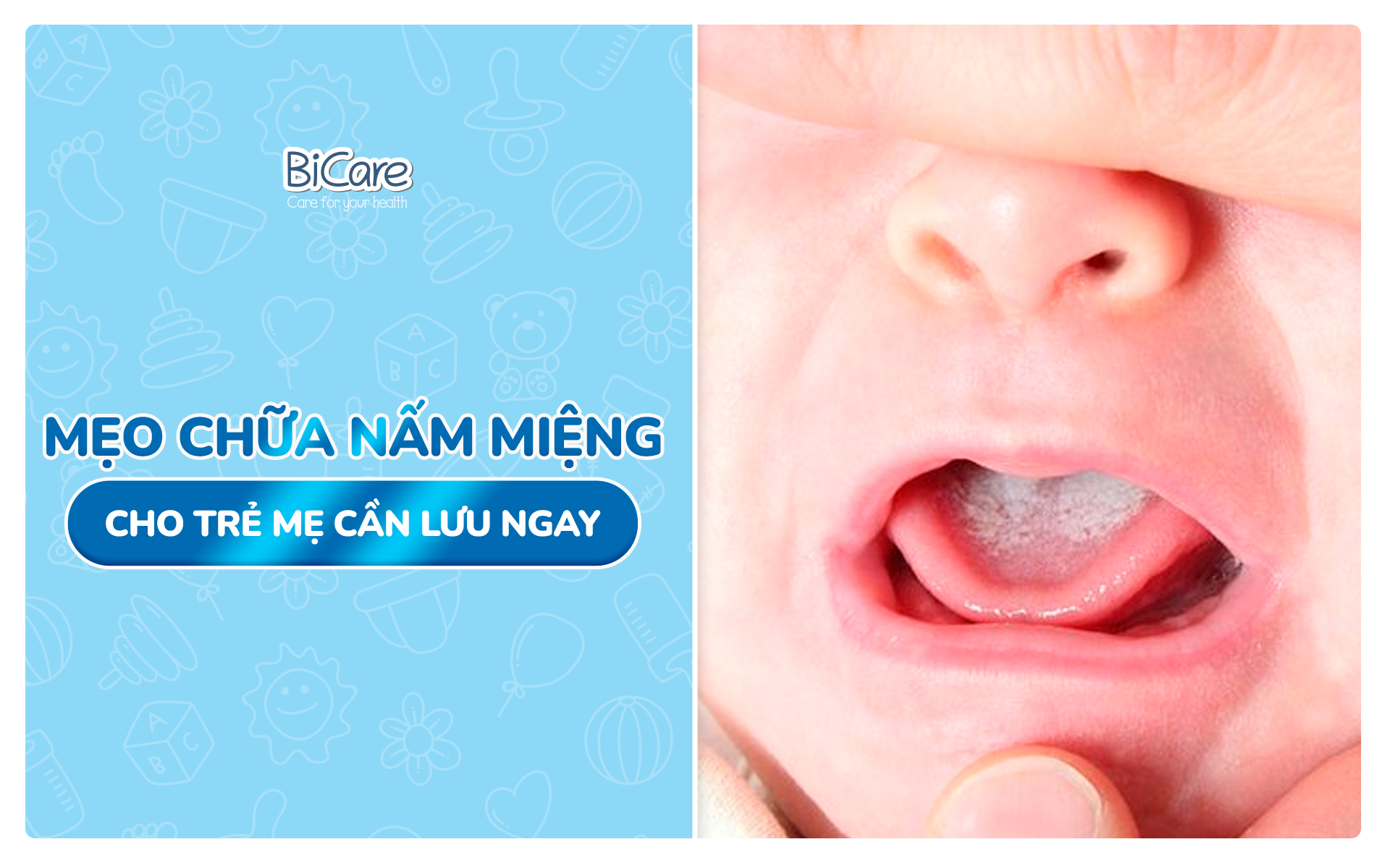 Mẹo chữa nấm miệng cho trẻ mẹ cần lưu lại ngay